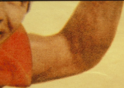 Closeup of arm